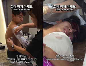 곽윤기, 3년째 문신 제거 고통 "마취해도 아파..살이 타는 느낌"