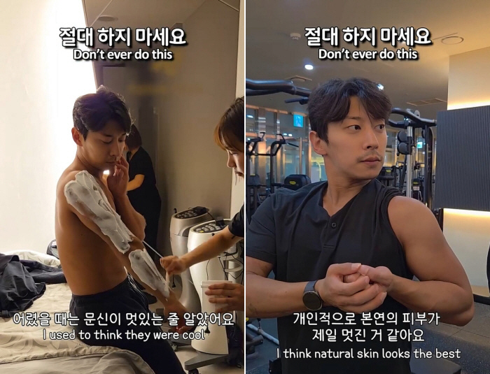 곽윤기, 3년째 문신 제거 고통 "마취해도 아파..살이 타는 느낌"