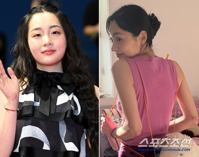 김민하, 확 달라진 체형..'뼈말라'된 근황에 "살 왜 이렇게 많이 빠졌냐"