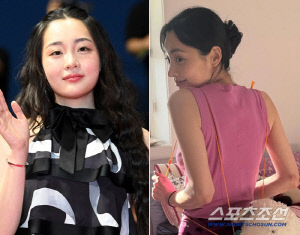 김민하, 확 달라진 체형..'뼈말라'된 근황에 "살 왜 이렇게 많이 빠졌냐"
