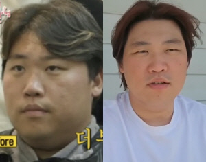 '홍현희 시매부' 천뚱, 몰라보게 야윈 충격 근황 "염증 방치하다 입원"