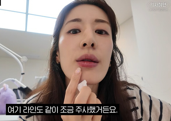 '주진모♥' 민혜연, 적나라한 '셀프 시술'..퉁퉁 부은 입술 공개 '깜짝'