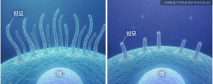 자폐 새로운 유전적 기전 규명…'유전자 쌍 변이', 연관성 높아져
