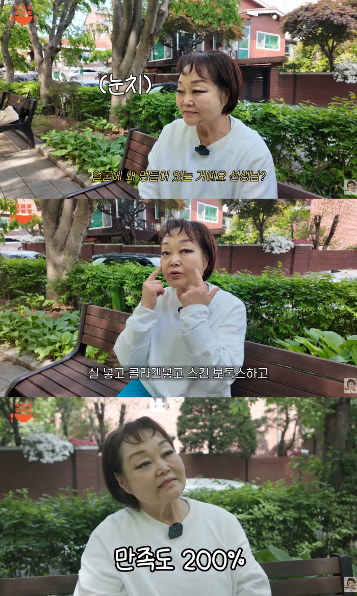 '빅마마' 이혜정, 성형외과 견적 1천만원 받더니..시술 후 달라진 얼굴 "만족도 200%"
