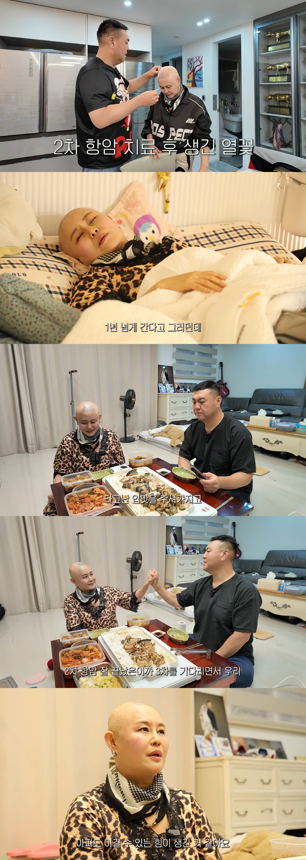 '난소암 3기' 홍주, 항암 후 두피 열꽃에 고통.."스트레스 극심해 병 생겨"