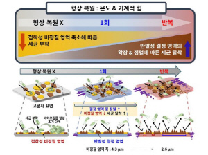 몸 안에 심는 의료기기에 세균 부착 막는 소재 개발