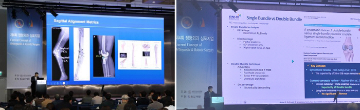 '제4회 정형외과 심포지엄'에서 임상 사례를 발표하고 있는 힘찬병원 이동녕 관절의학연구소 연구부소장(왼쪽)과 경상국립대학교병원 정형외과 황선철 교수.