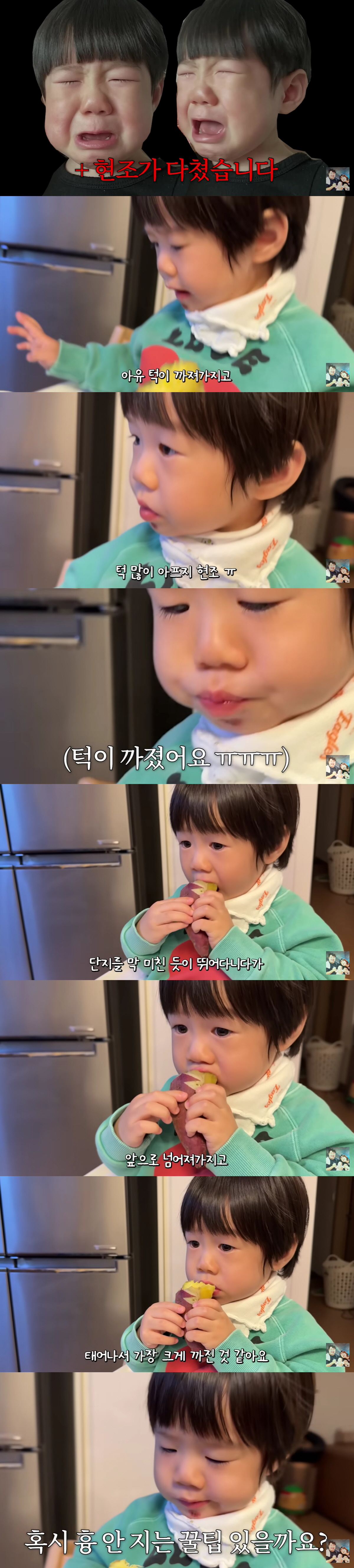 강재준♥이은형, 1살子 얼굴 상처에 눈물 "태어나서 가장 크게 다쳐, 도와달라"