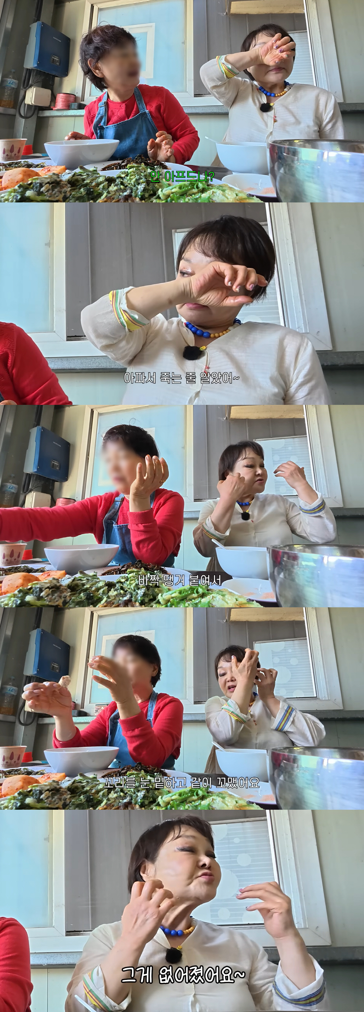 '68세' 이혜정, 실리프팅 시술 전후 깜짝.."심부볼 사라져"