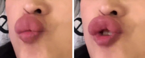 손주 발에 뽀뽀한 할머니 입술, 소시지처럼 부어…놀라운 이유