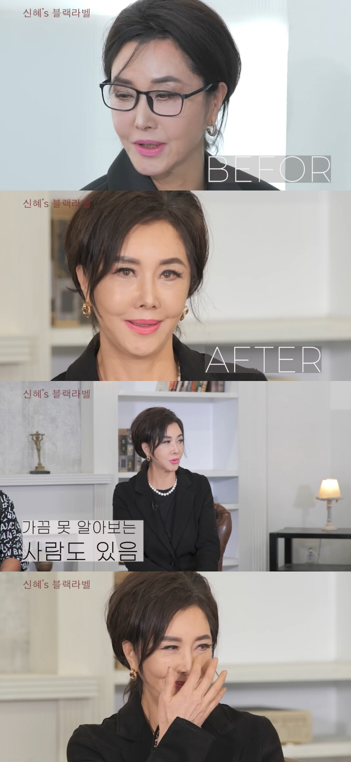 '62세' 유혜리, 안면거상+지방 재배치 후 확 달라진 외모 "못 알아볼 정도"