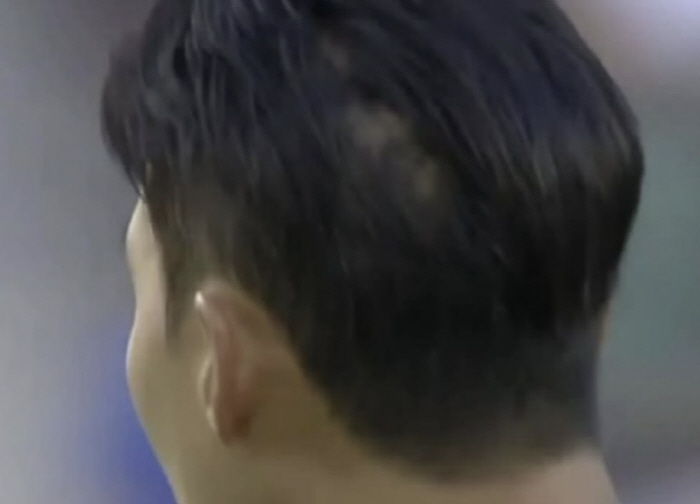 사진=중계화면 캡처