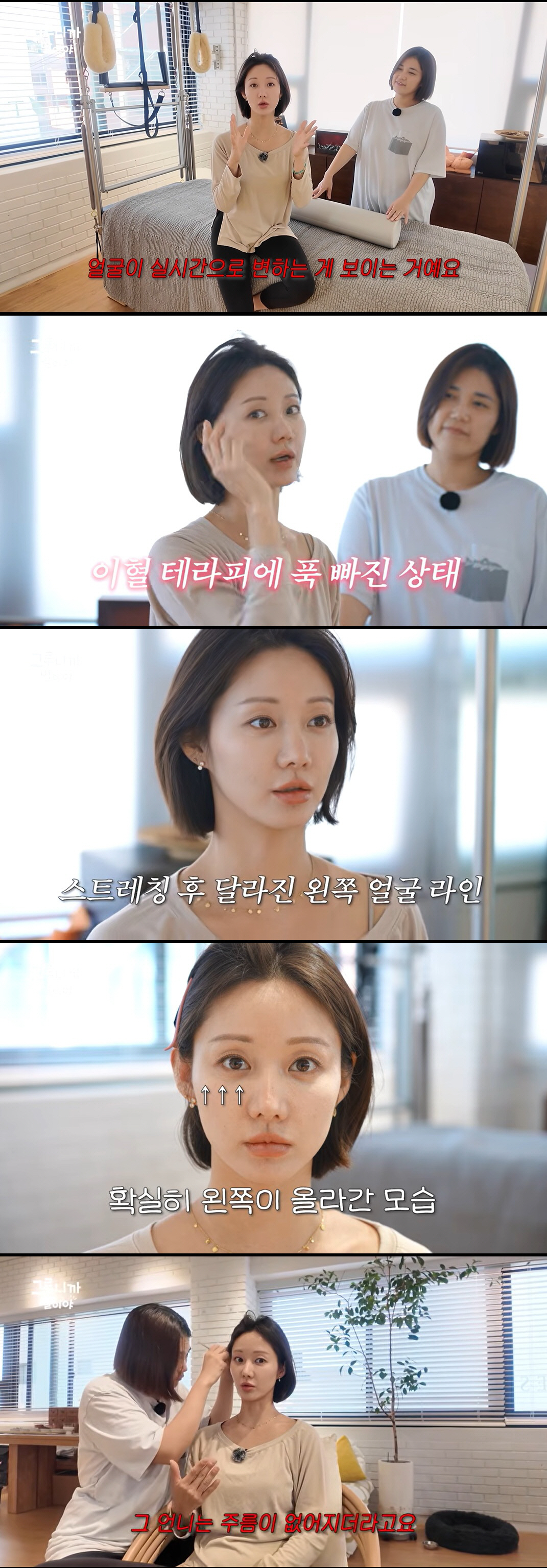 한그루, 이혈 테라피로 확 달라졌다…전후 차이에 충격 "얼굴이 반만 올라가"