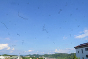 "이렇게 보이시나요?" 비문증 의심…젊은 층도 주의해야