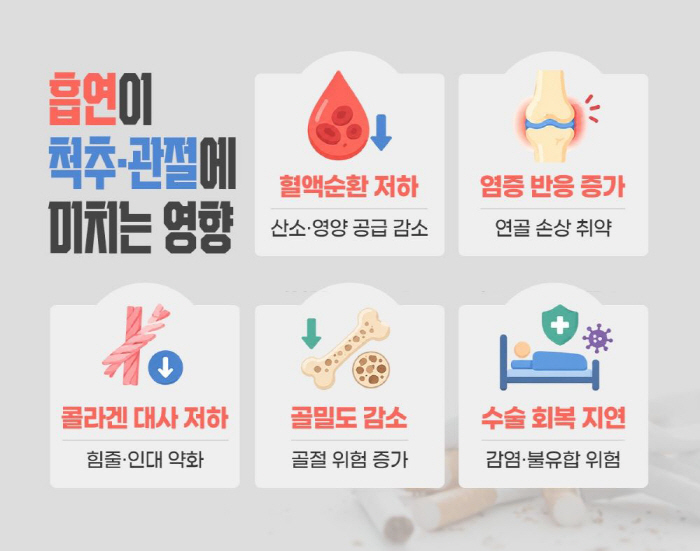 "흡연, 척추·관절 건강도 위협"…주변 조직 약화에 수술 후 회복도 더뎌