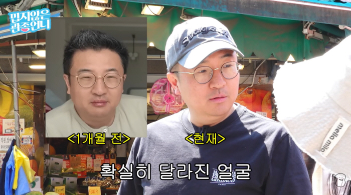 이지혜 남편, 마운자로 한달만 확 달라진 얼굴·뱃살..."팔다리 너무 얇아"