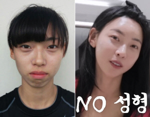 '솔지5' 김민지, 하관 작아진 비결 "치아 8개 뽑고 교정 4년..성형 NO"