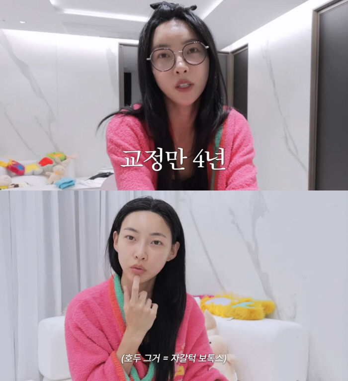 '솔지5' 김민지, 하관 작아진 비결 "치아 8개 뽑고 교정 4년..성형 NO"
