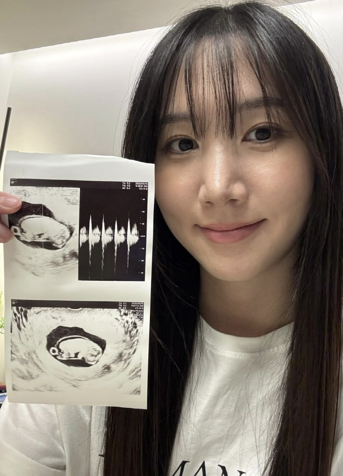 '에이핑크 탈퇴' 홍유경, 의사 결혼 3년만 기쁜 소식 "임신 16주차, 태명은 당당이"