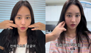 상담실장 된 육지담, 실리프팅 시술 흔적까지 적나라한 공개 “놀랍게도 직후”