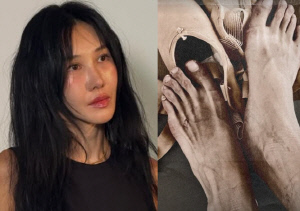 '엄태웅♥' 윤혜진, 발레슈즈 벗자 드러난 '변형된 발가락'...'시누이' 엄정화도 응원