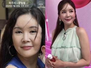 "진짜 용됐다" 장영란, 2년전 사진에 깜짝...'쌍꺼풀 4번 거상술' 효과 실감