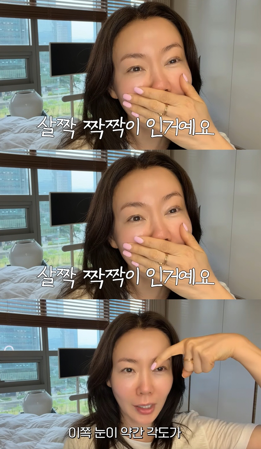 안선영, 짝짝이 눈매에 결국 쌍꺼풀 의사 다시 찾아가.."세 땀 다시 떴다 멍"