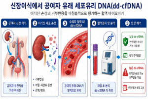 신장이식 후 '거부반응 정밀 선별' 혈액검사 입증…불필요한 조직검사 최소화