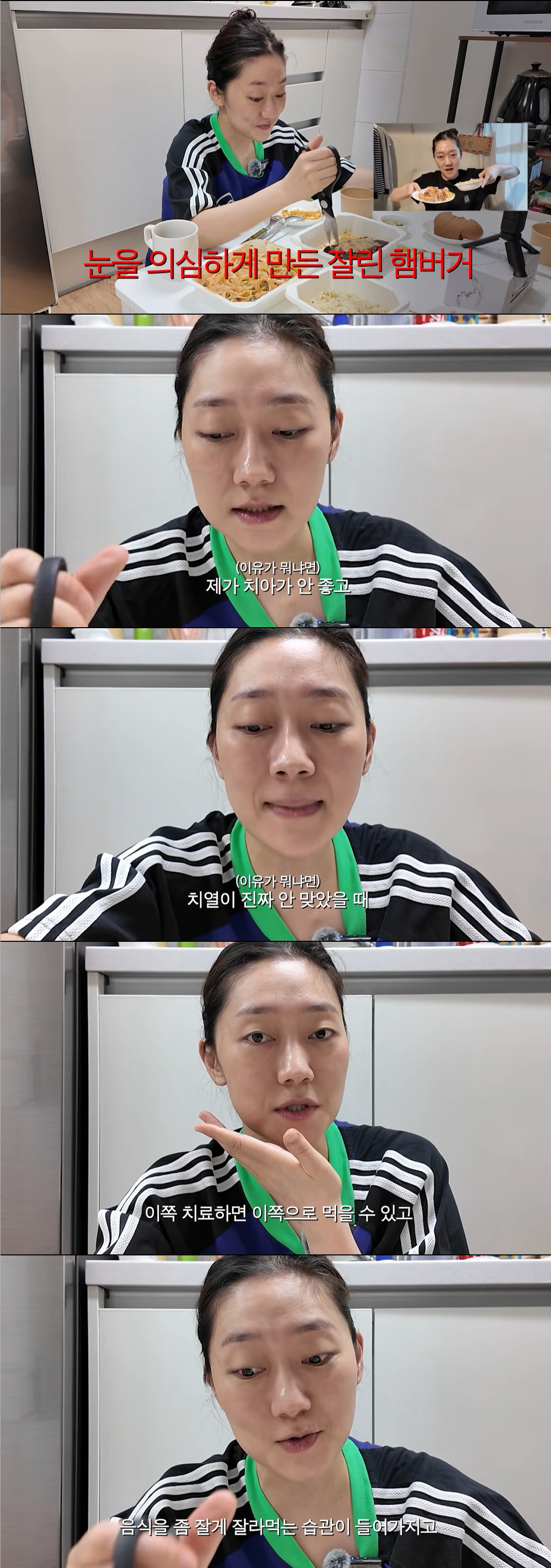 박경혜, '3,000만 원' 양악수술한 이유 "치열 안 맞아 음식 양쪽으로 못 씹어"