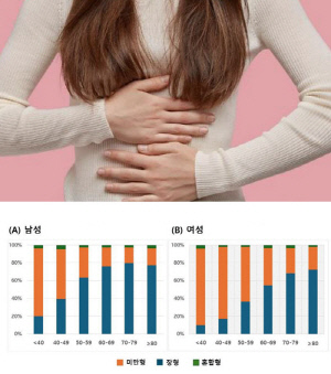 "50세 미만 여성, 남성보다 위암 생존율 낮아"…호르몬 변화 추정