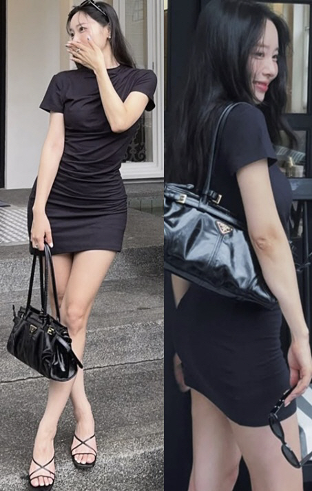 '박성광♥' 이솔이, 종아리보톡스 효과 이 정도였나..42kg '뼈말라' 각선미