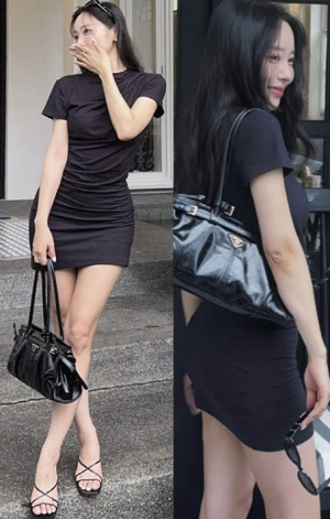 '박성광♥' 이솔이, 종아리보톡스 효과 이 정도였나..42kg '뼈말라' 각선미