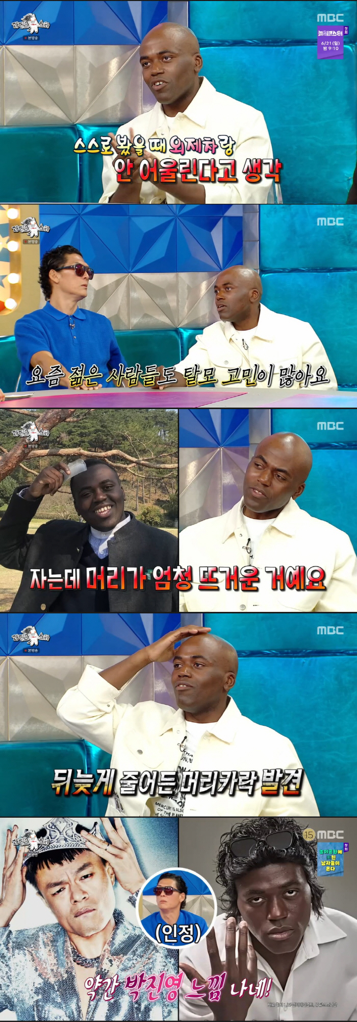Jonathan Shaves His Head as Hair Loss Worsens: "My Head Has Felt Hot Since I Was 19, I’m Thinking of a Hair Transplant Using Body Hair" ('Radio Star')
