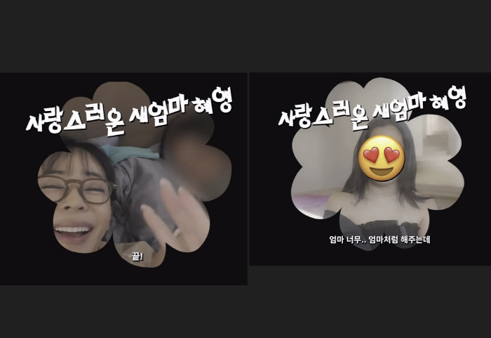 Lee Hye-young, after lung cancer surgery, says her whole body is covered in scars... "They removed my lung through my side"