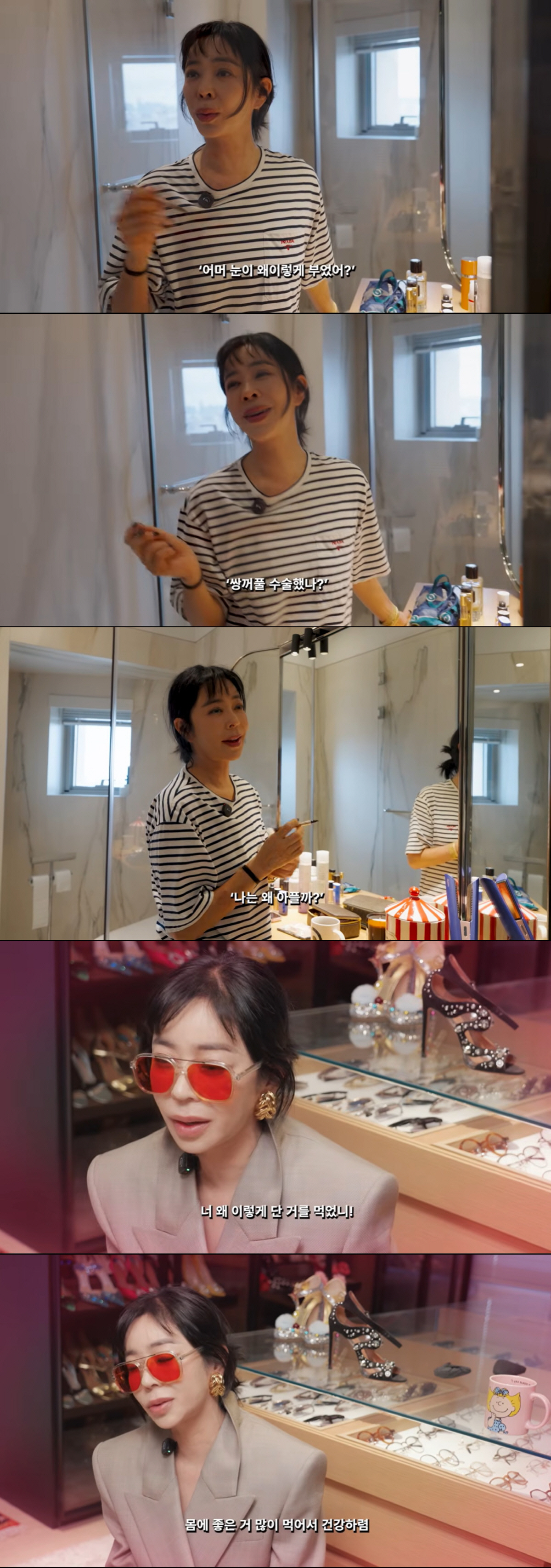 '폐암 투병' 이혜영, 아파서 부은 눈에 쌍수 오해 "왜 이렇게 살아야 하나 우울"