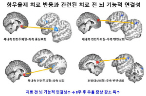 "우울증 청소년 항우울제 치료 반응, 치료 전 '뇌 기능적 연결성'으로 예측"