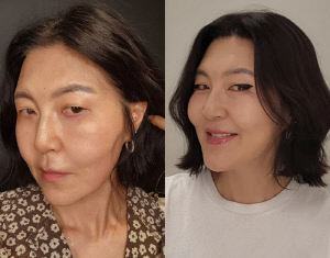 한혜연, 16kg 감량했지만 "살 빠지면서 턱선 무너져"…리프팅 시술 고백