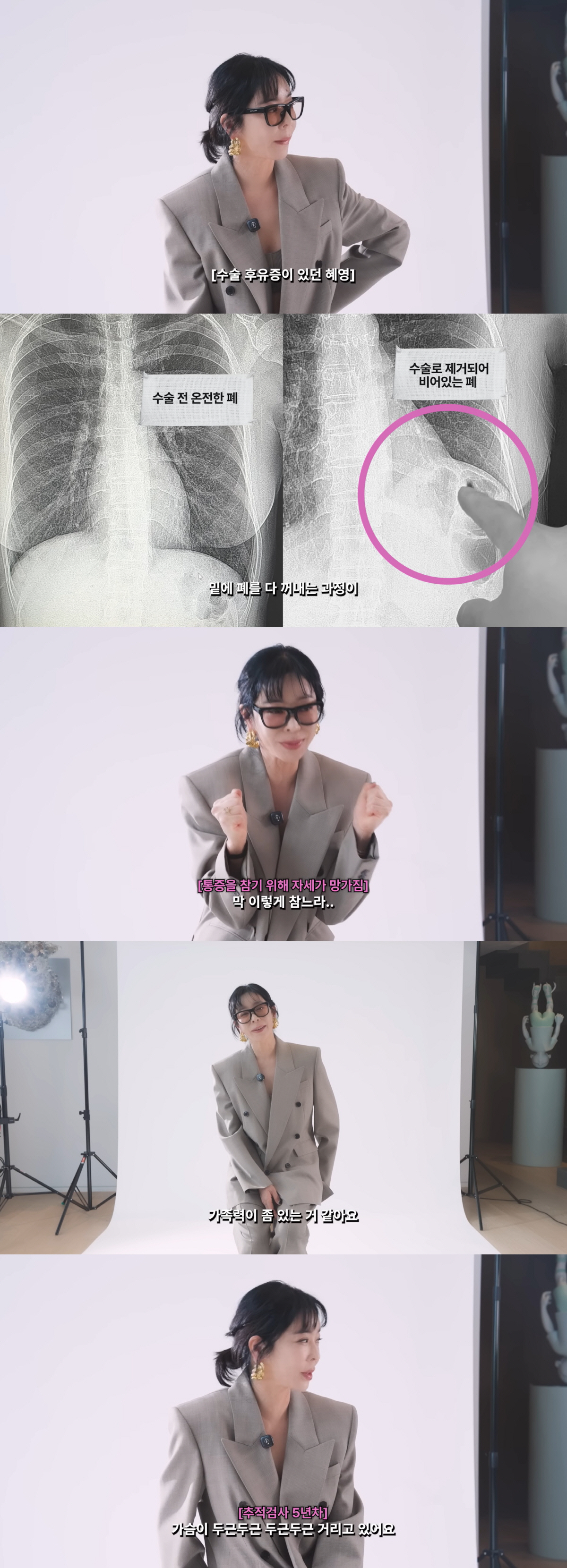 '폐암 투병' 이혜영 "갈비뼈 잘라 폐 꺼낸 수술 무리였다, 통증 참느라 목디스크 걸려"