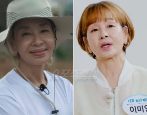이미영, 뒤집어진 입술..필러 부작용 고백 "공업용 물질 넣어 제거 수술만 두 번"