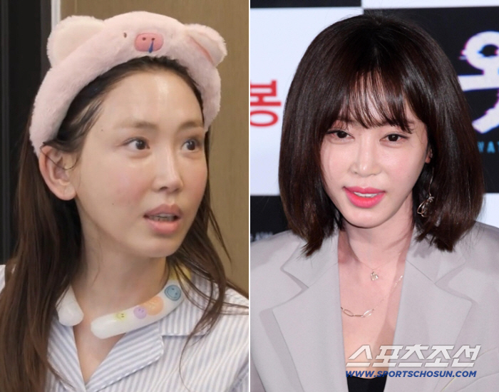 강예원, 앞트임 포함 7번 손댔다 "성형 실패 후 스트레스..몰래 수술"