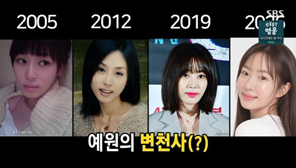 '성형 7번' 강예원, 21년 외모 변천사 공개 "수술 자국 없애려 계속 해" ('미우새')