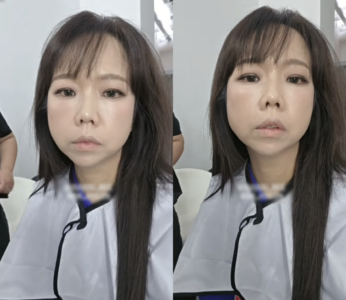 ‘49kg’ 홍현희, 살이 얼마나 더 빠진 거야…반쪽된 얼굴 '몰라볼 지경'