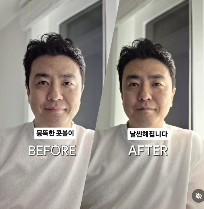 '박지윤과 파경' 최동석, 이혼 후 달라진 얼굴..얼마나 변했길래 코끝이 쑥 "콧볼 줄고 콧대 올라가"