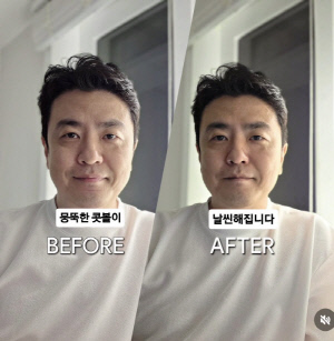'박지윤과 파경' 최동석, 이혼 후 달라진 얼굴..얼마나 변했길래 코끝이 쑥 "콧볼 줄고 콧대 올라가"
