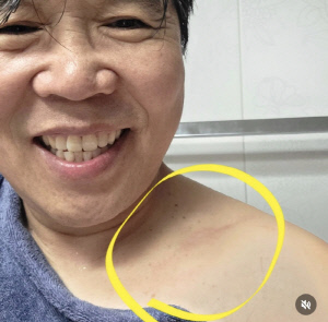 정은표, 쇄골·갈비뼈·팔꿈치 골절..11년 전 은퇴 고민하게 만든 부상