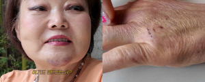 '빅마마' 이혜정, 멍투성이 얼굴에 손 찢어진 충격 근황 "아프니까 죽음 연상돼"