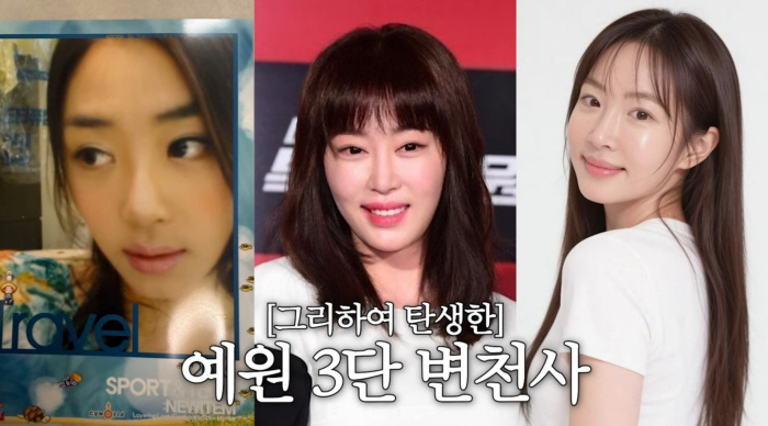 강예원, 성형 전후 3단 변천사 "앞트임 망해 눈 성형만 6번..코도 살짝"