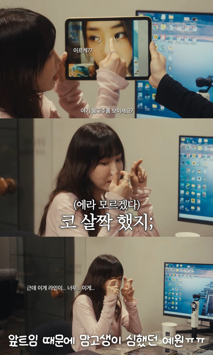 강예원, 성형 전후 3단 변천사 "앞트임 망해 눈 성형만 6번..코도 살짝"