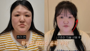 이국주, 韓 떠나 확 달라진 얼굴…홈케어로 갸름해진 턱선 "처져서 관리 해야"