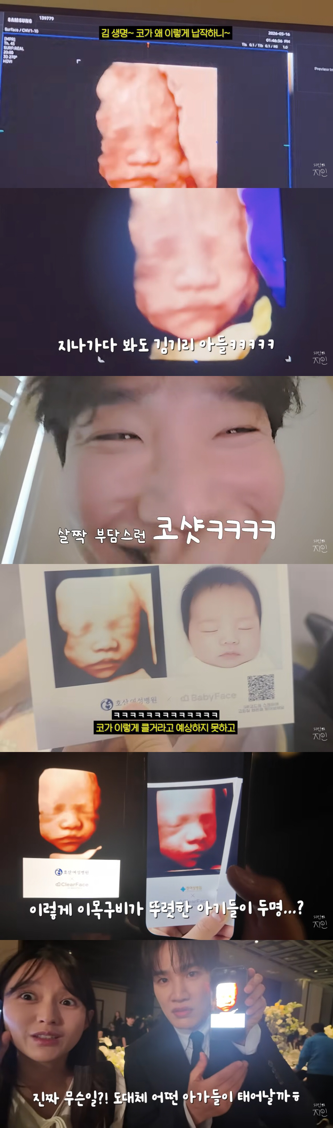 김기리♥문지인, 子 얼굴 처음 보고 당황 "코가 왜 이렇게 납작해?"